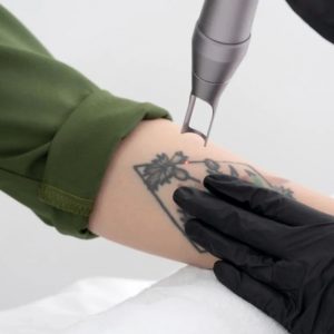 Membresía láser zona M