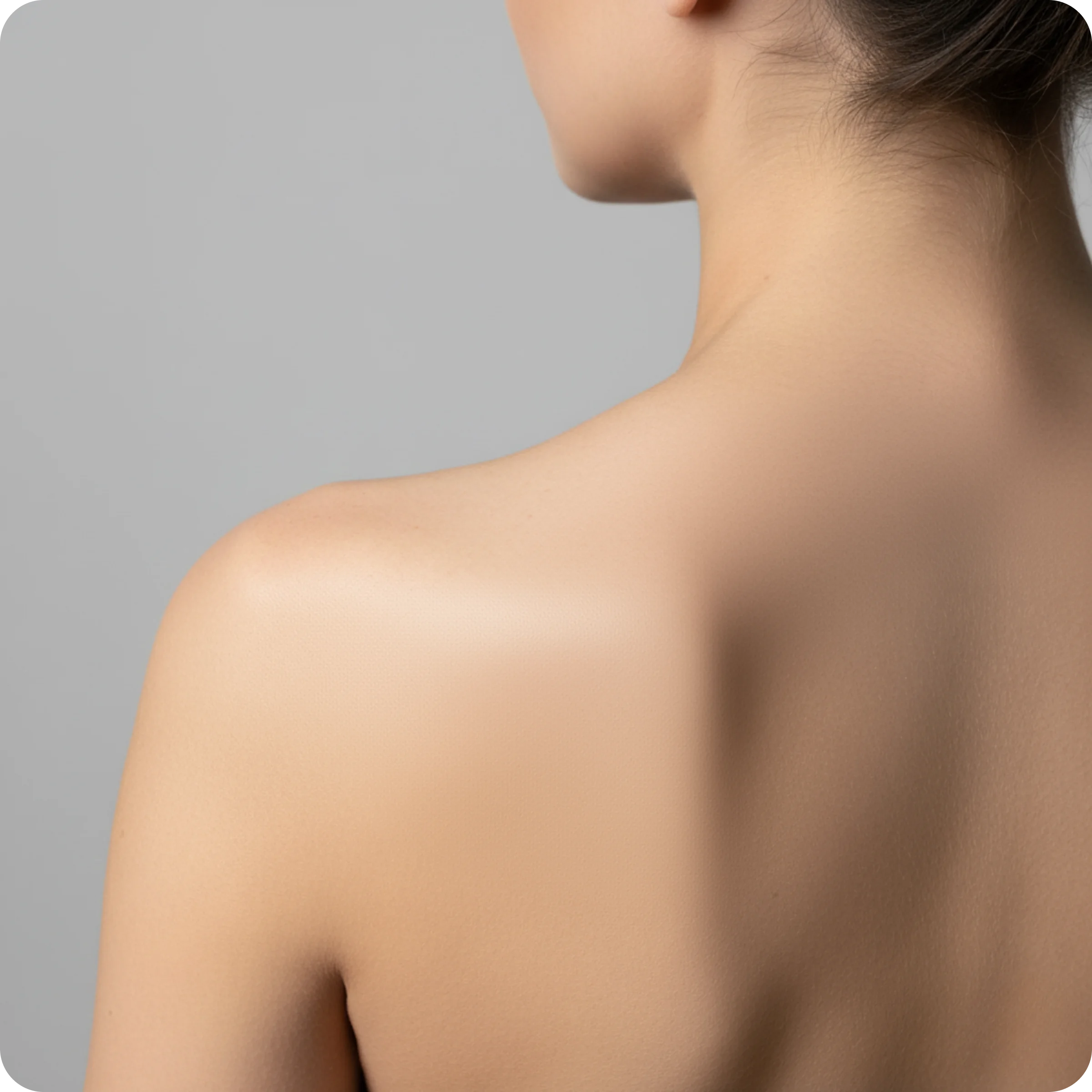 Antes del tratamiento