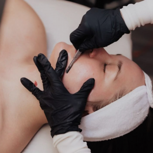 Dermaplaning Facial