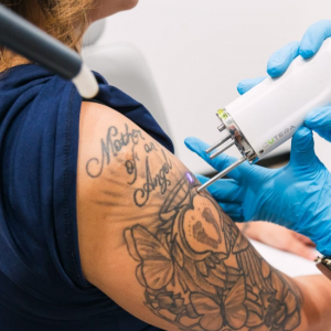 Membresía láser zona XL