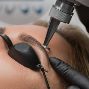 Membresía láser zona XS