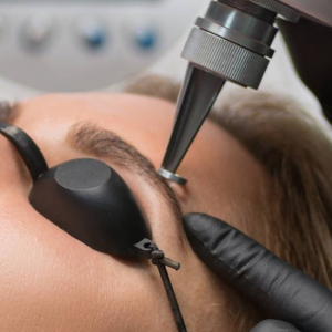 Membresía láser zona XS